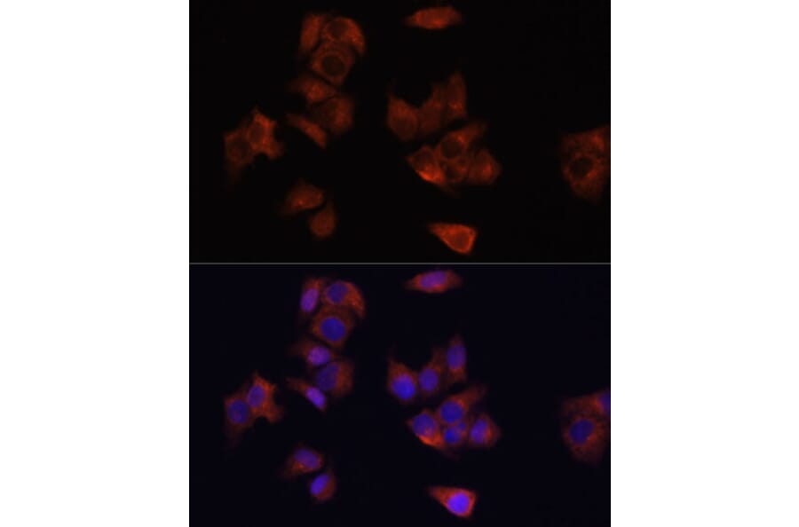 Immunofluorescence - Anti-LAMP1 Antibody (A80581) - Antibodies.com