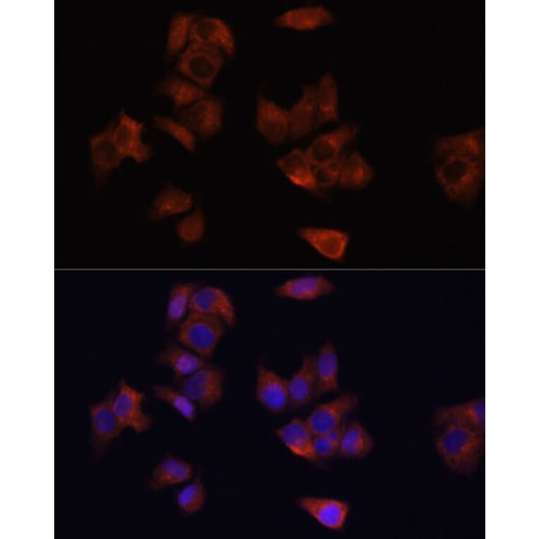 Immunofluorescence - Anti-LAMP1 Antibody (A80581) - Antibodies.com