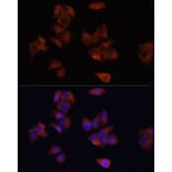 Immunofluorescence - Anti-LAMP1 Antibody (A80581) - Antibodies.com