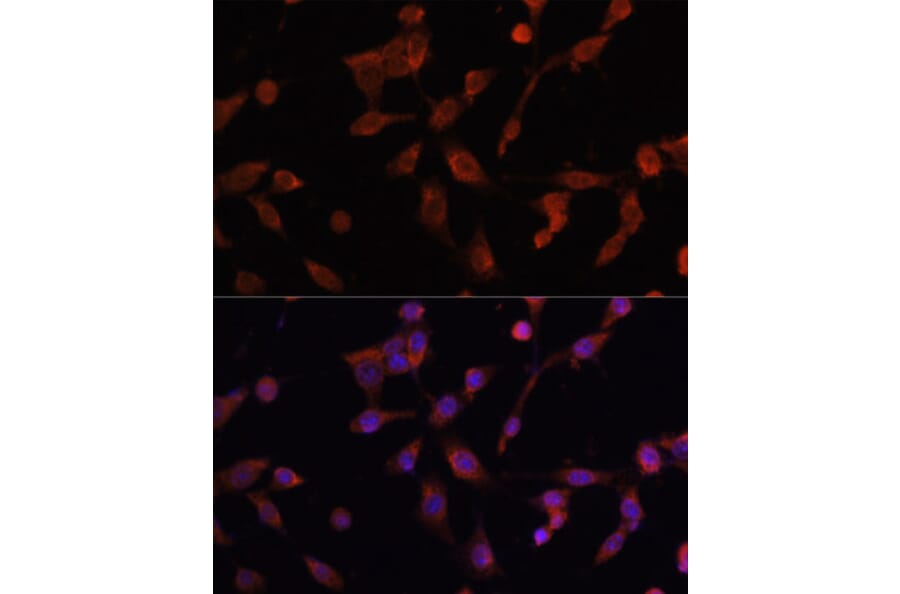 Immunofluorescence - Anti-LAMP1 Antibody (A80581) - Antibodies.com