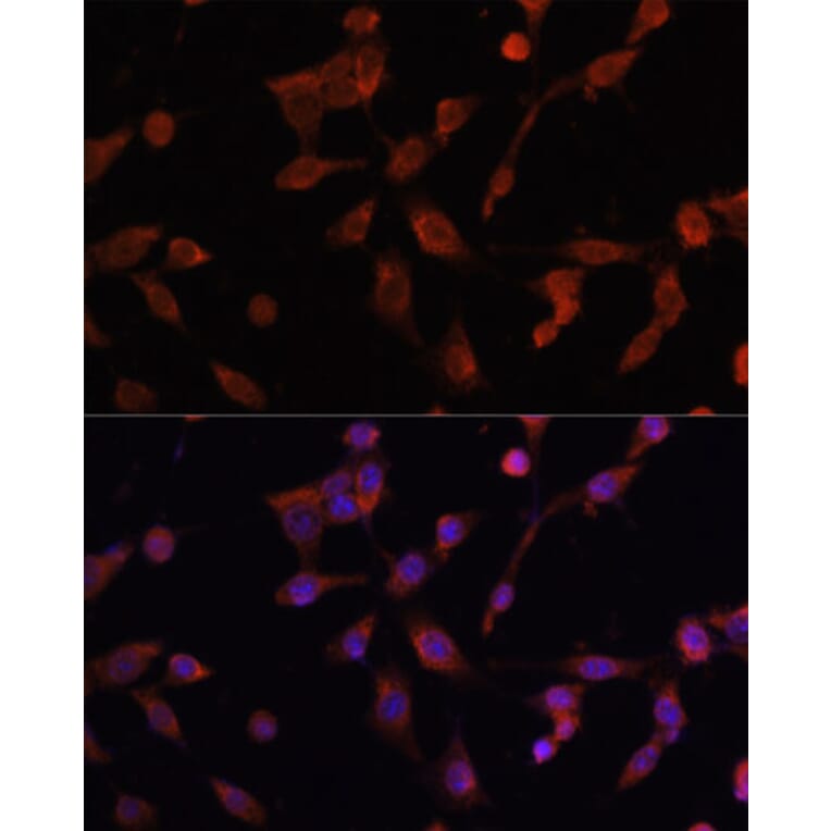 Immunofluorescence - Anti-LAMP1 Antibody (A80581) - Antibodies.com
