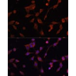 Immunofluorescence - Anti-LAMP1 Antibody (A80581) - Antibodies.com