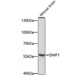 Western Blot - Anti-DMP1 Antibody (A80585) - Antibodies.com