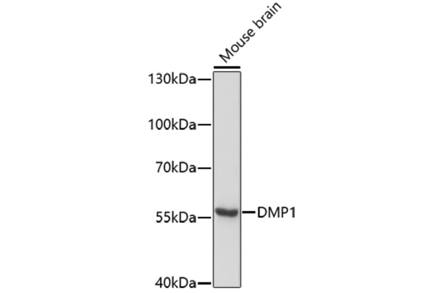Western Blot - Anti-DMP1 Antibody (A80585) - Antibodies.com