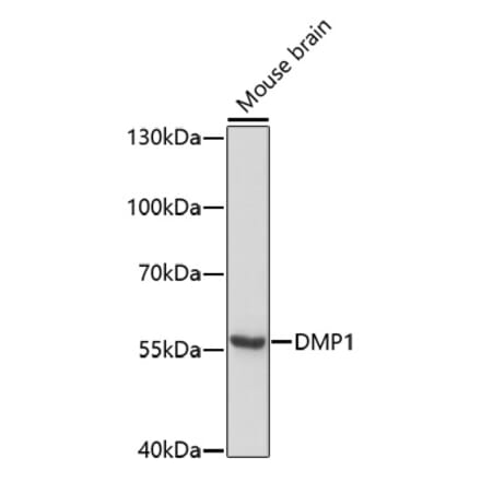 Western Blot - Anti-DMP1 Antibody (A80585) - Antibodies.com