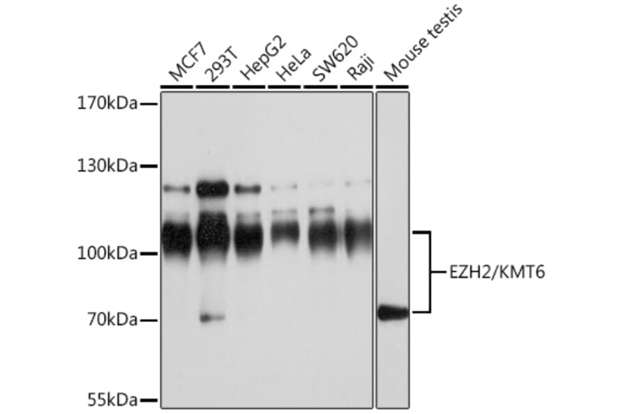 Western Blot - Anti-EZH2 Antibody (A80586) - Antibodies.com