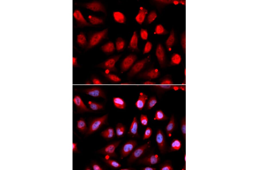 Immunofluorescence - Anti-EZH2 Antibody (A80586) - Antibodies.com