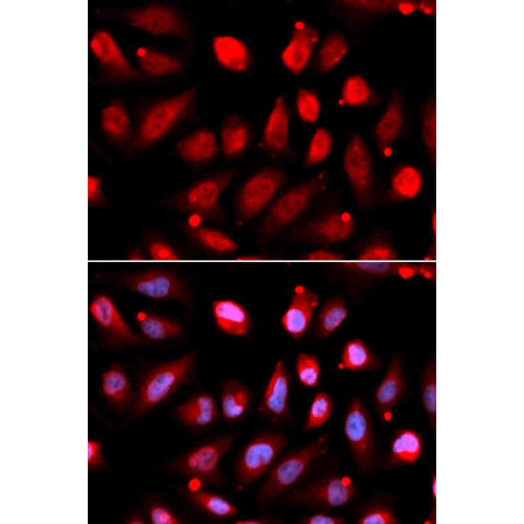 Immunofluorescence - Anti-EZH2 Antibody (A80586) - Antibodies.com