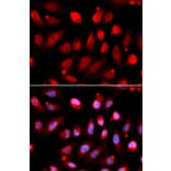 Immunofluorescence - Anti-EZH2 Antibody (A80586) - Antibodies.com