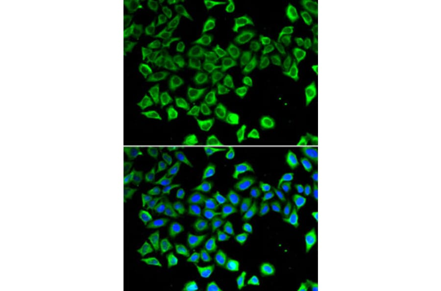 Immunofluorescence - Anti-Lipocalin-2 / NGAL Antibody (A80587) - Antibodies.com