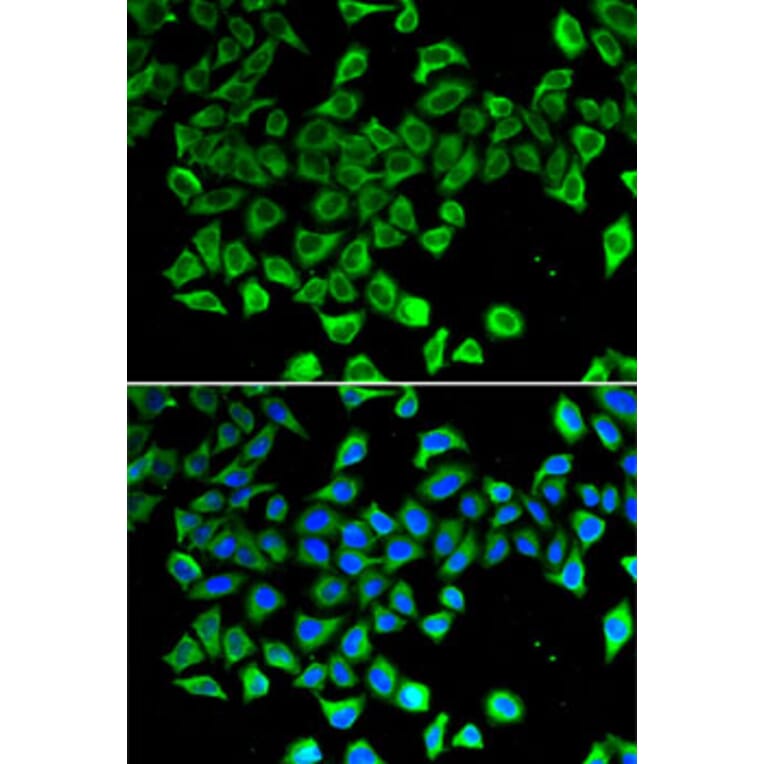 Immunofluorescence - Anti-Lipocalin-2 / NGAL Antibody (A80587) - Antibodies.com
