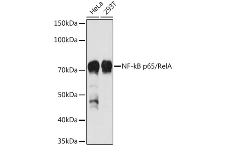Western Blot - Anti-NF-kB p65 Antibody (A80588) - Antibodies.com