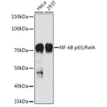 Western Blot - Anti-NF-kB p65 Antibody (A80588) - Antibodies.com