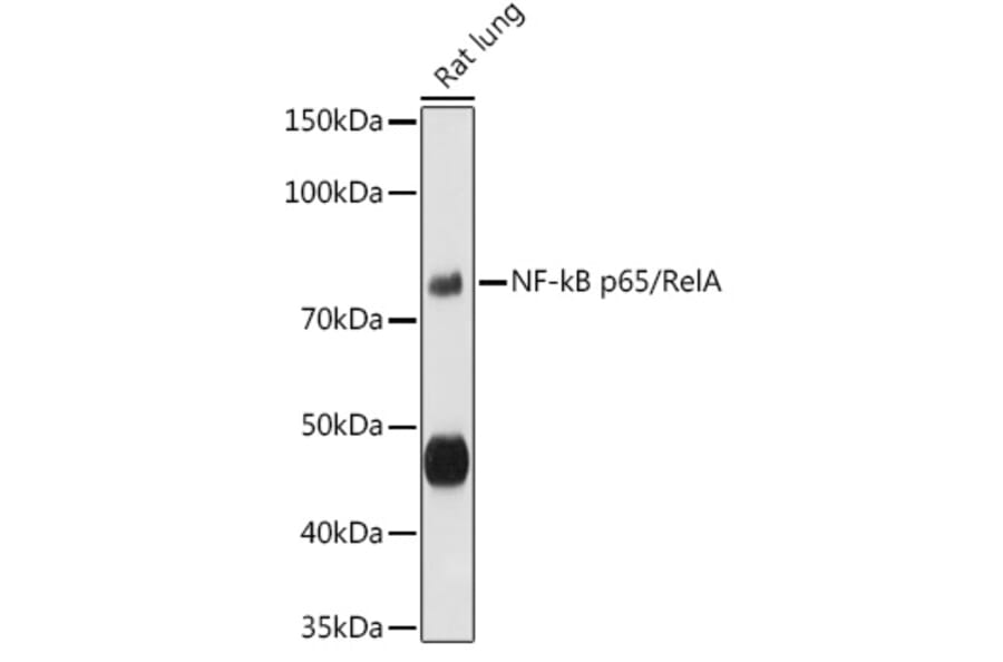 Western Blot - Anti-NF-kB p65 Antibody (A80588) - Antibodies.com