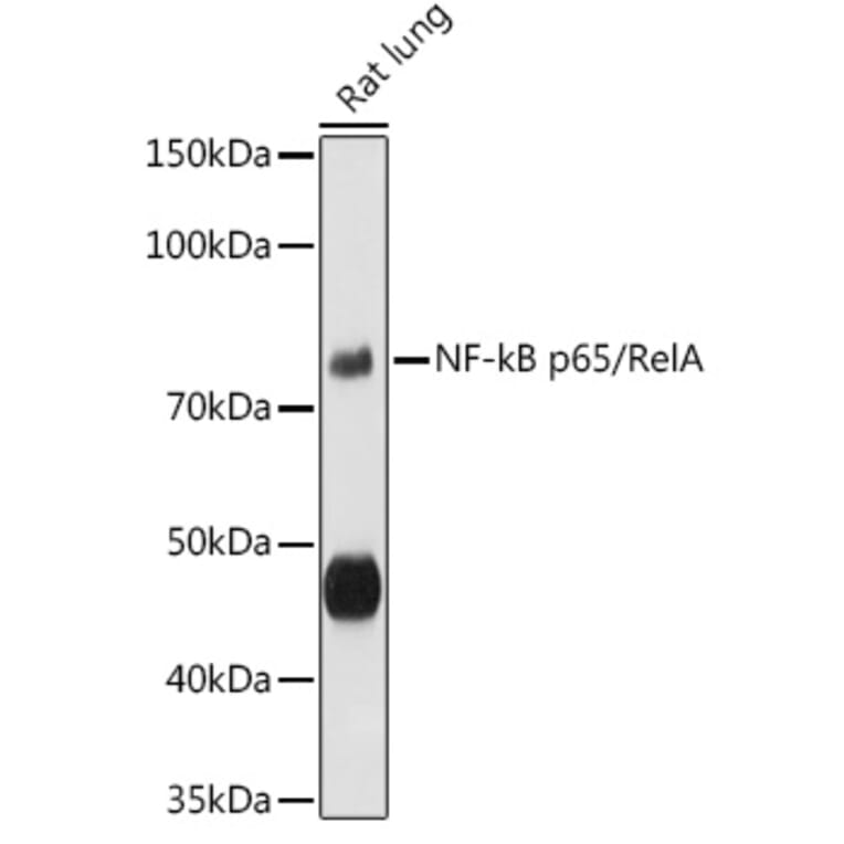 Western Blot - Anti-NF-kB p65 Antibody (A80588) - Antibodies.com