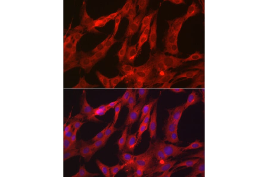 Immunofluorescence - Anti-NF-kB p65 Antibody (A80588) - Antibodies.com