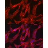 Immunofluorescence - Anti-NF-kB p65 Antibody (A80588) - Antibodies.com