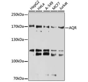 Western Blot - Anti-IBP160 Antibody (A80590) - Antibodies.com
