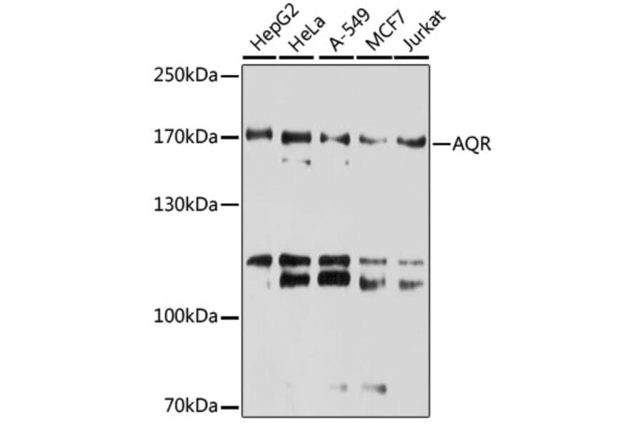 Western Blot - Anti-IBP160 Antibody (A80590) - Antibodies.com