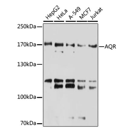 Western Blot - Anti-IBP160 Antibody (A80590) - Antibodies.com