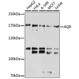 Western Blot - Anti-IBP160 Antibody (A80590) - Antibodies.com