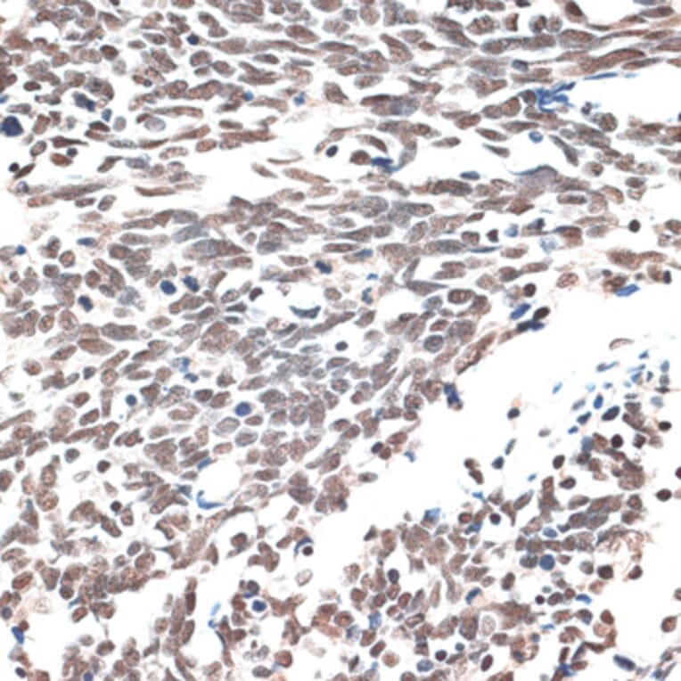 Immunohistochemistry - Anti-IBP160 Antibody (A80590) - Antibodies.com
