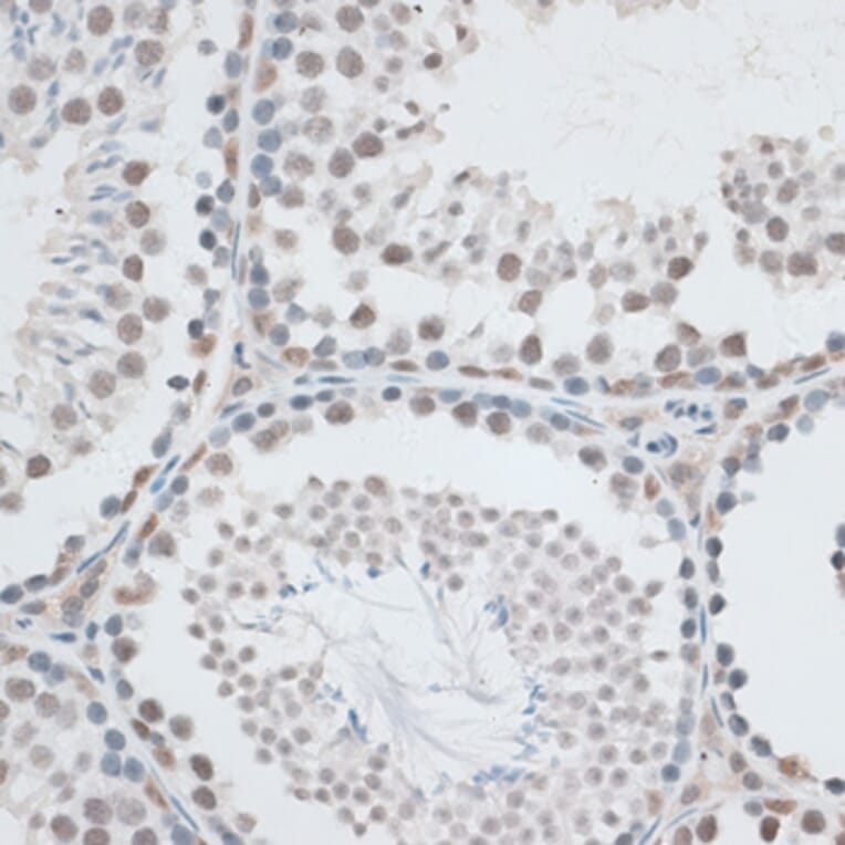 Immunohistochemistry - Anti-IBP160 Antibody (A80590) - Antibodies.com