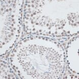 Immunohistochemistry - Anti-IBP160 Antibody (A80590) - Antibodies.com
