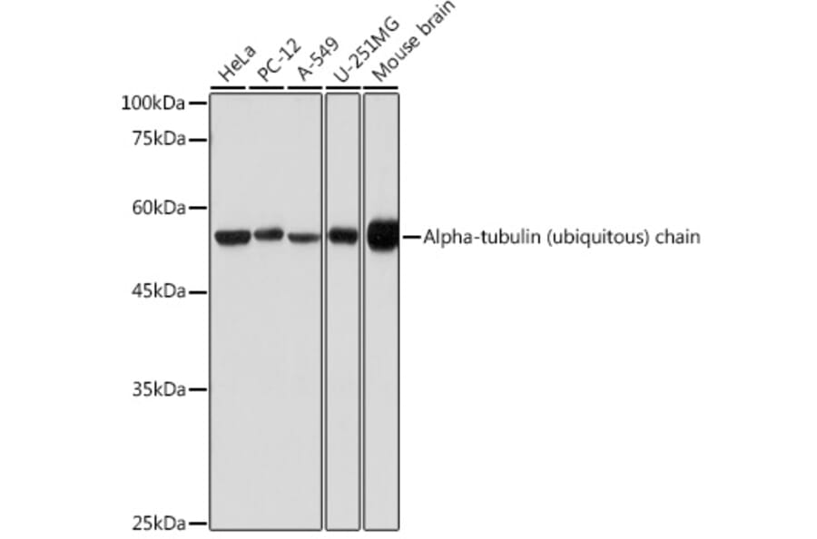 Western Blot - Anti-Tubulin Antibody (A80592) - Antibodies.com