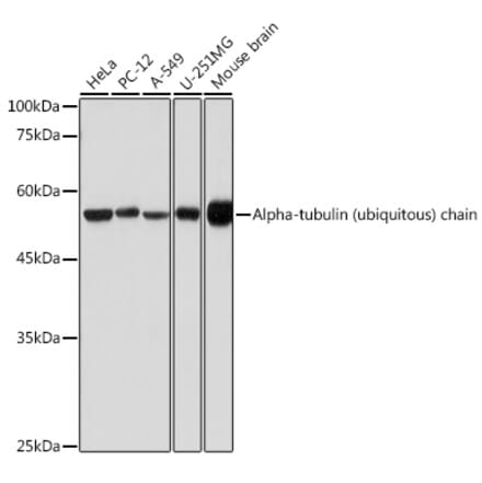 Western Blot - Anti-Tubulin Antibody (A80592) - Antibodies.com