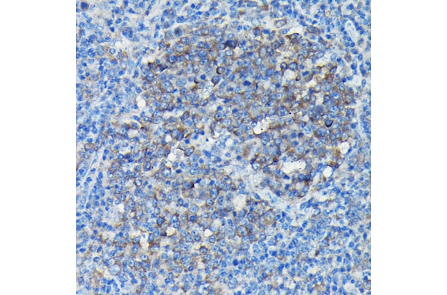 Immunohistochemistry - Anti-Tubulin Antibody (A80592) - Antibodies.com