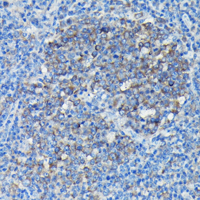 Immunohistochemistry - Anti-Tubulin Antibody (A80592) - Antibodies.com