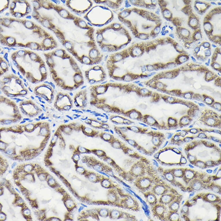 Immunohistochemistry - Anti-Tubulin Antibody (A80592) - Antibodies.com
