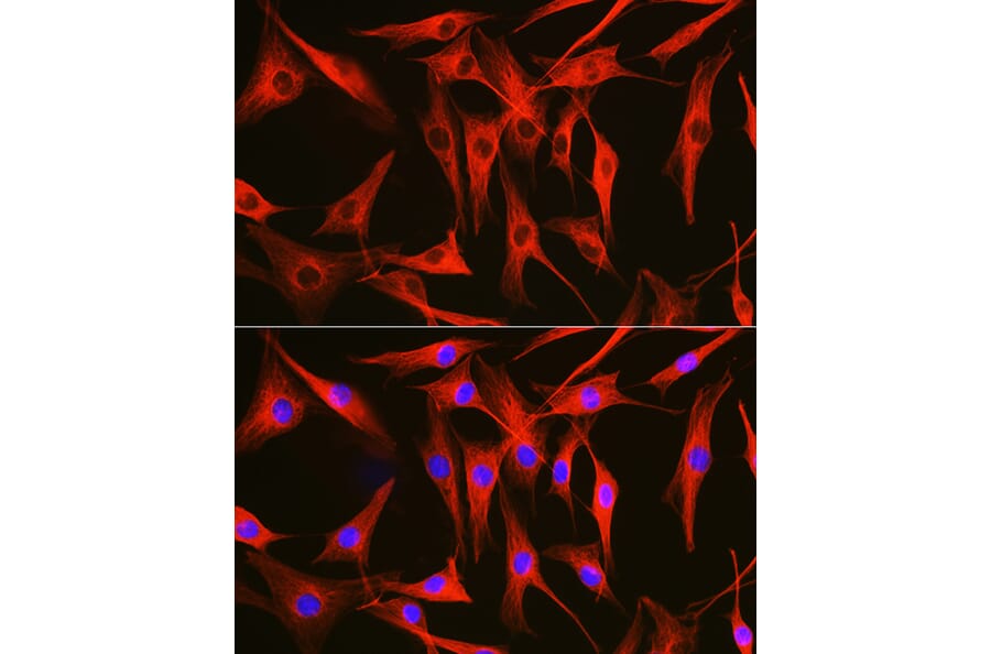 Immunofluorescence - Anti-Tubulin Antibody (A80592) - Antibodies.com