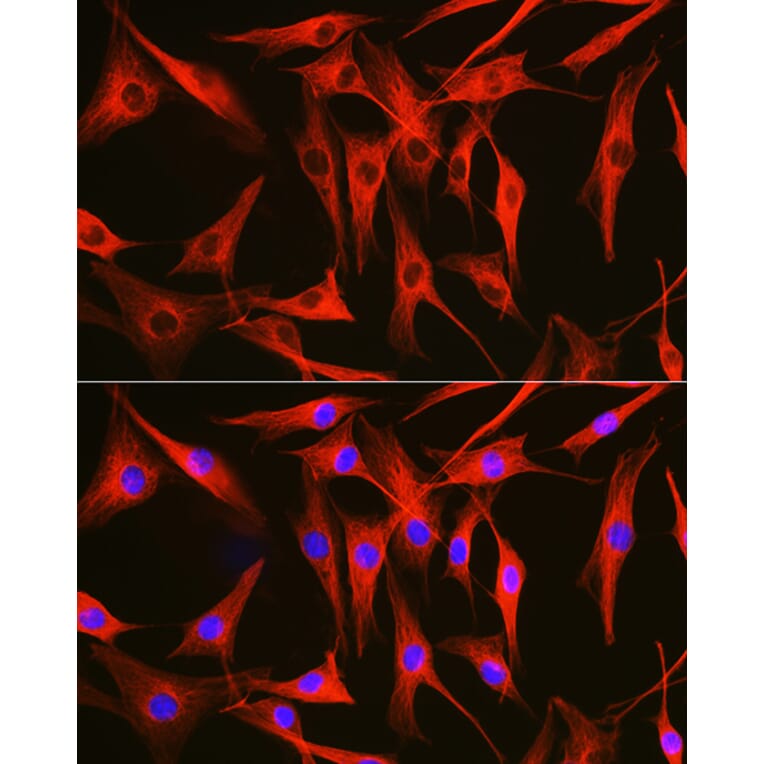 Immunofluorescence - Anti-Tubulin Antibody (A80592) - Antibodies.com