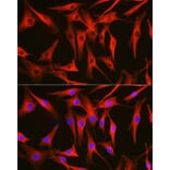 Immunofluorescence - Anti-Tubulin Antibody (A80592) - Antibodies.com