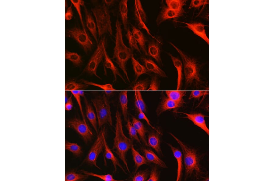 Immunofluorescence - Anti-Tubulin Antibody (A80592) - Antibodies.com