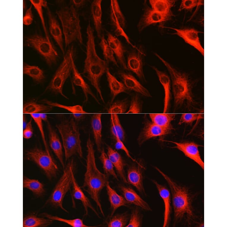 Immunofluorescence - Anti-Tubulin Antibody (A80592) - Antibodies.com