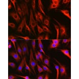 Immunofluorescence - Anti-Tubulin Antibody (A80592) - Antibodies.com