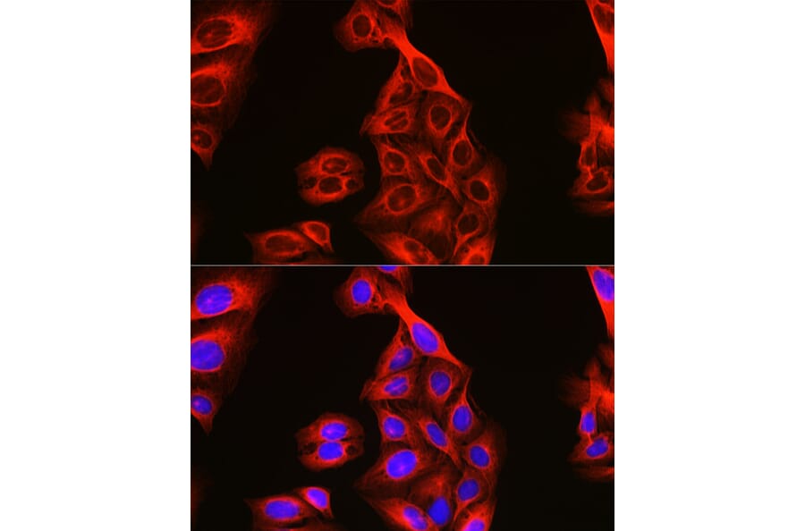 Immunofluorescence - Anti-Tubulin Antibody (A80592) - Antibodies.com