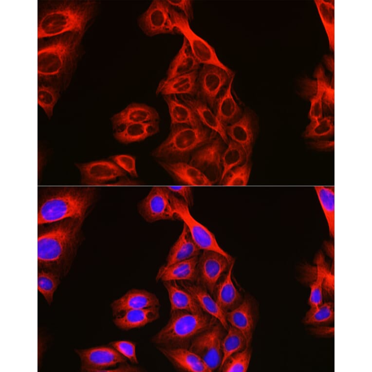 Immunofluorescence - Anti-Tubulin Antibody (A80592) - Antibodies.com