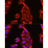 Immunofluorescence - Anti-Tubulin Antibody (A80592) - Antibodies.com