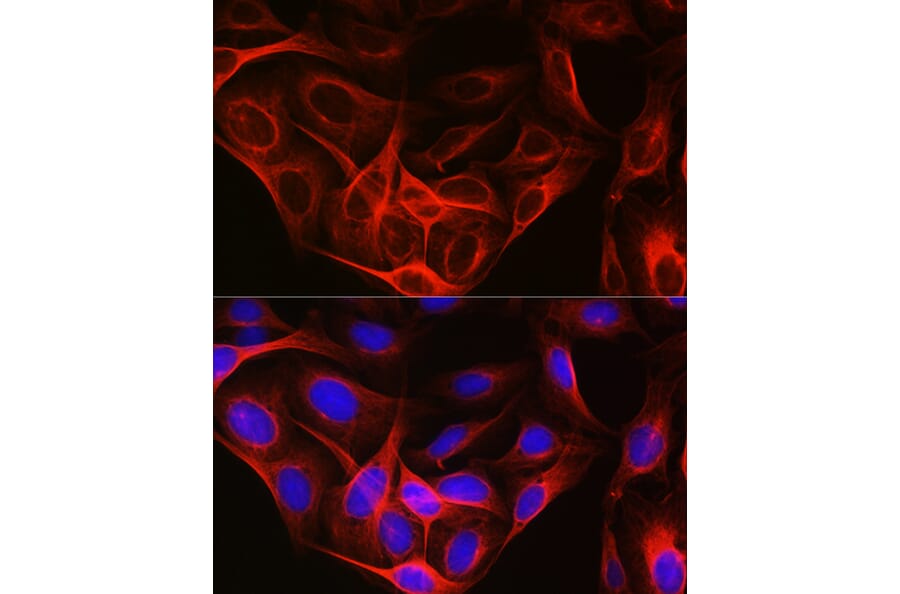 Immunofluorescence - Anti-Tubulin Antibody (A80593) - Antibodies.com