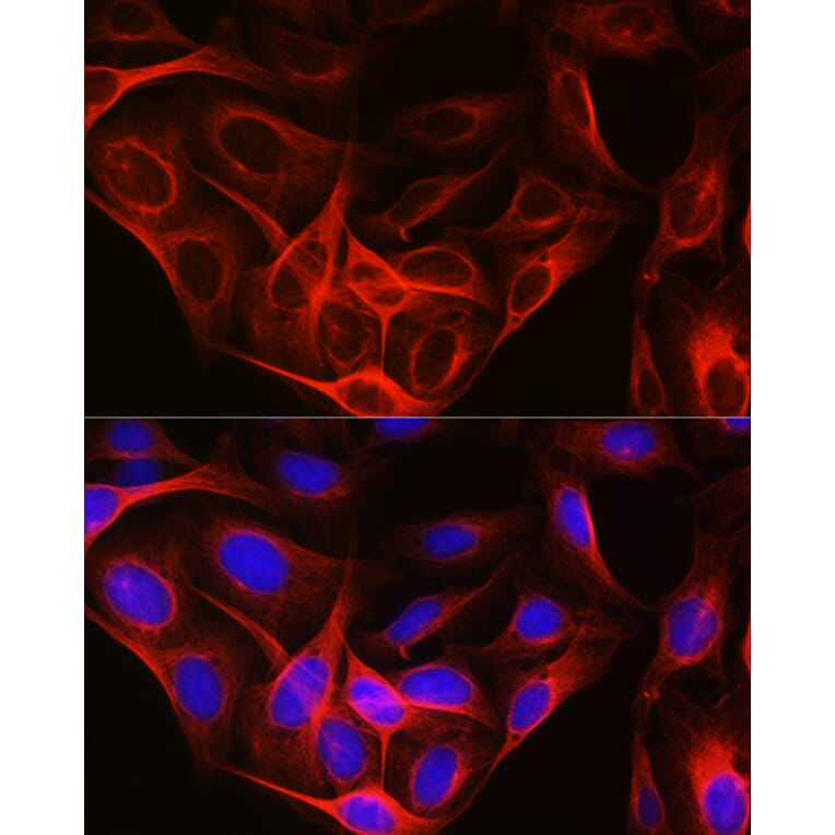 Immunofluorescence - Anti-Tubulin Antibody (A80593) - Antibodies.com