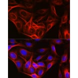 Immunofluorescence - Anti-Tubulin Antibody (A80593) - Antibodies.com