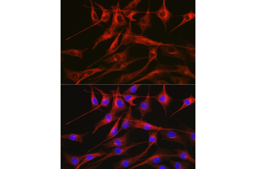 Immunofluorescence - Anti-Tubulin Antibody (A80593) - Antibodies.com