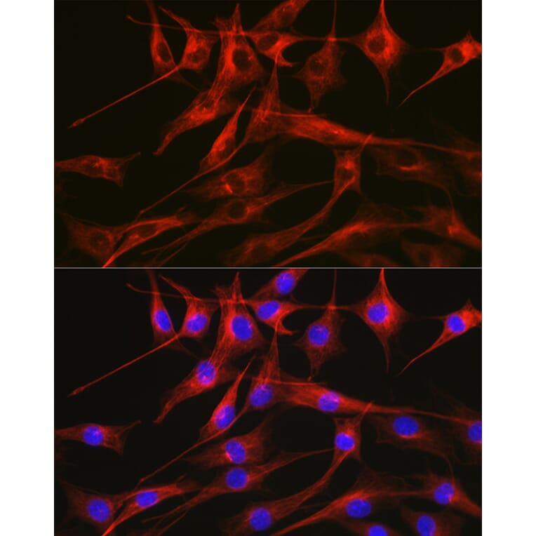 Immunofluorescence - Anti-Tubulin Antibody (A80593) - Antibodies.com