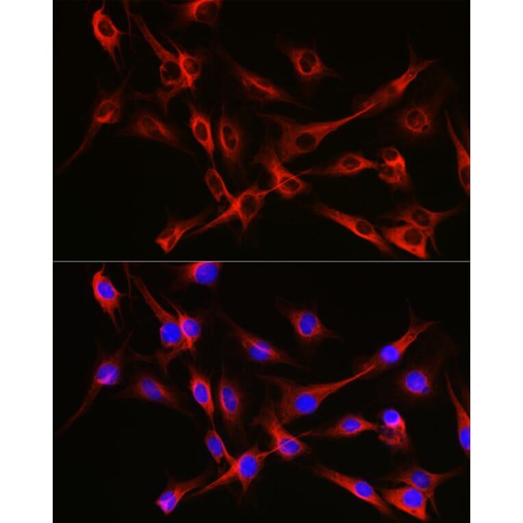 Immunofluorescence - Anti-Tubulin Antibody (A80593) - Antibodies.com