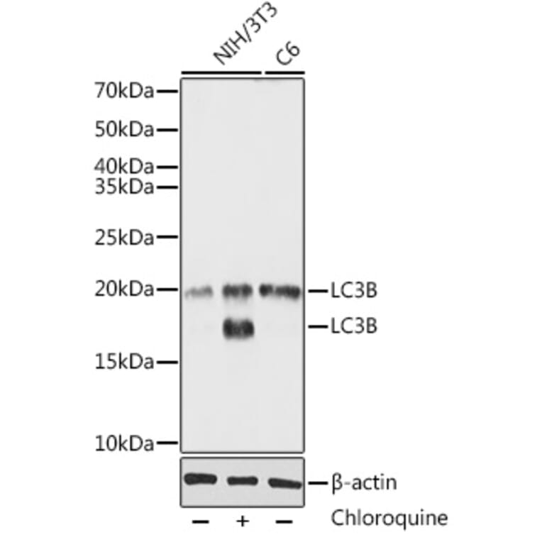 Western Blot - Anti-LC3B Antibody (A80596) - Antibodies.com