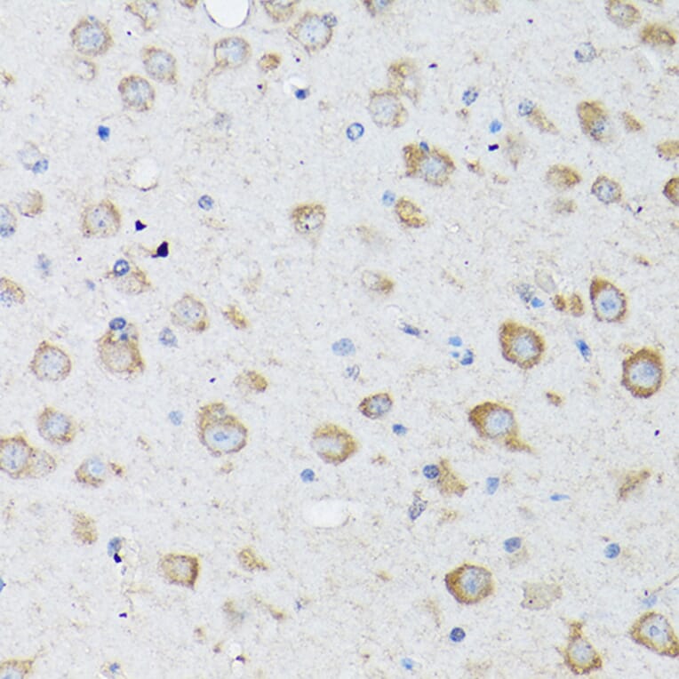 Immunohistochemistry - Anti-LC3B Antibody (A80596) - Antibodies.com